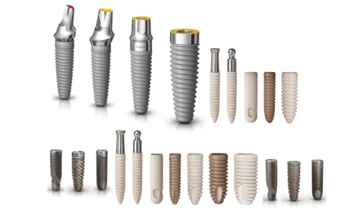 Types of Dental Implants