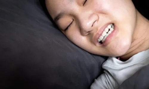 How to Stop Grinding Teeth in Sleep Naturally