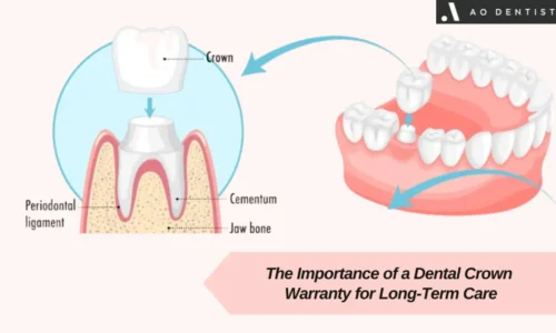 Dental Crowns Warranty