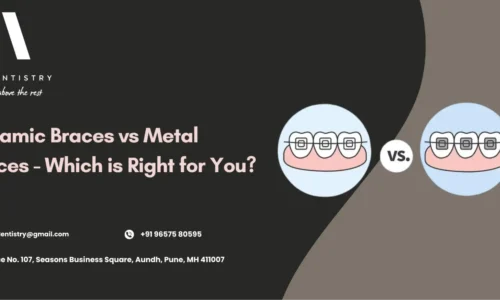 Ceramic Braces vs Metal Braces