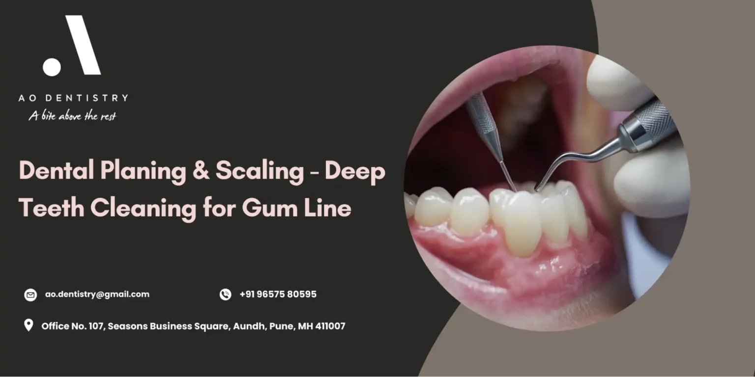 Planing and Scaling Teeth