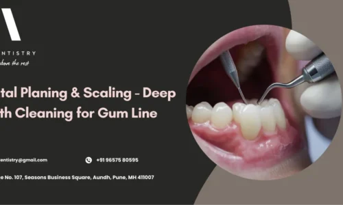 Planing and Scaling Teeth