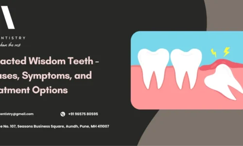 impacted wisdom teeth