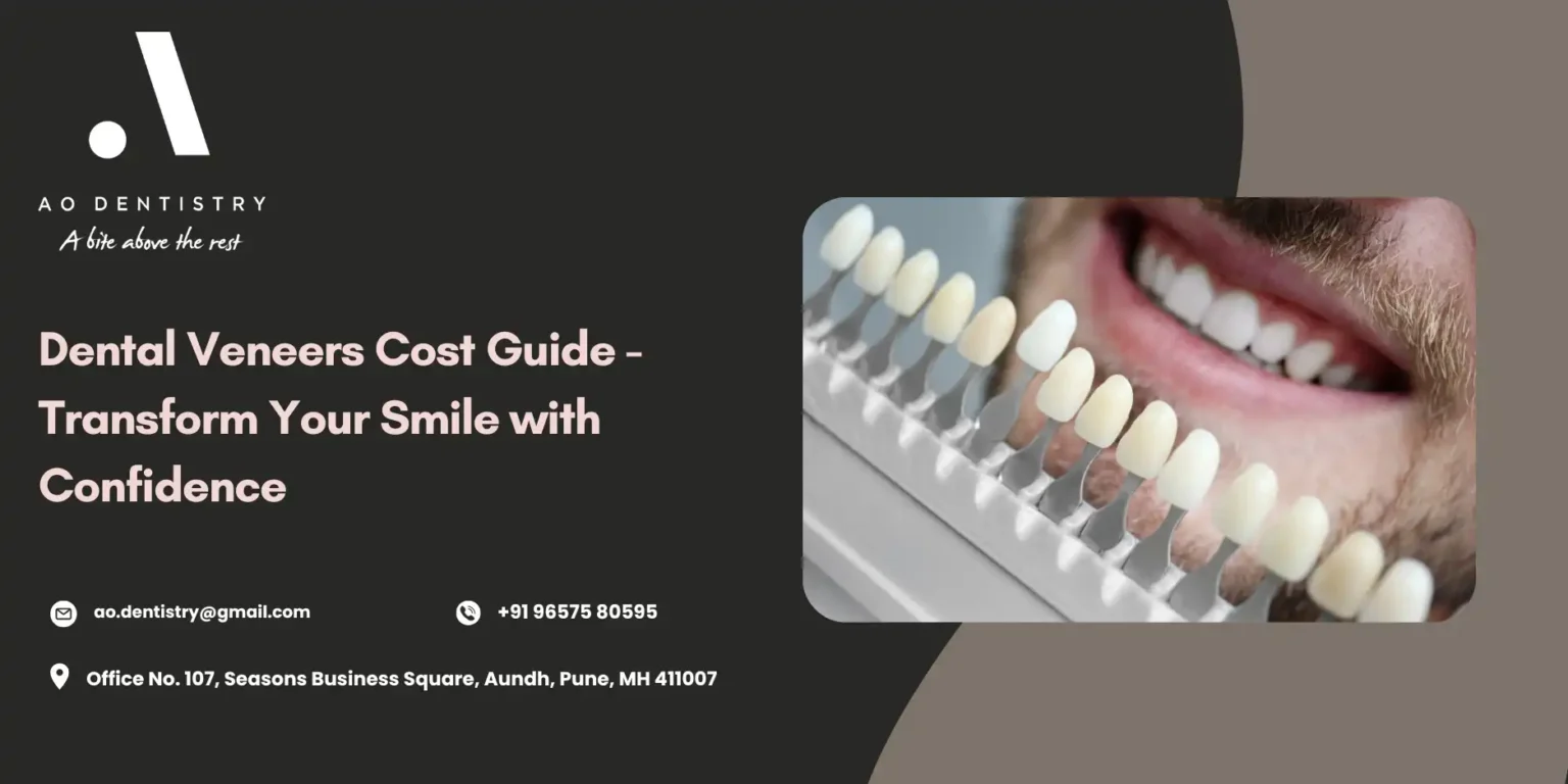Veneers Cost